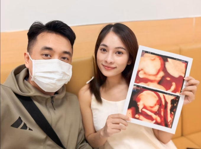 Vợ chồng Dương Khắc Linh khoe giấy siêu âm tuần thai thứ 17.